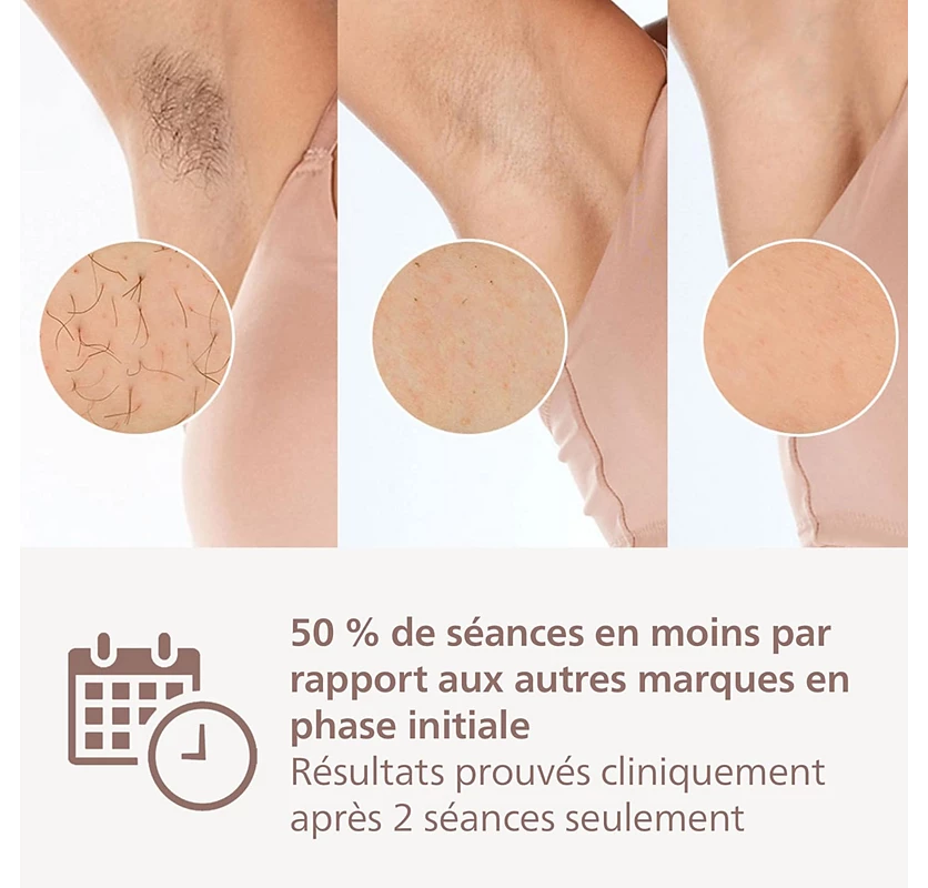 Philips Lumea Epilateur à lumiere pulsee Serie 8000 - Epilateur avec technologie SenseIQ, 2 embouts pour le corps et le visage, utilisation filaire (modèle BRI944/00)
