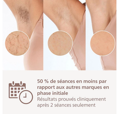 Philips Lumea Epilateur à lumiere pulsee Serie 8000 - Epilateur avec technologie SenseIQ, 2 embouts pour le corps et le visage, utilisation filaire (modèle BRI944/00)